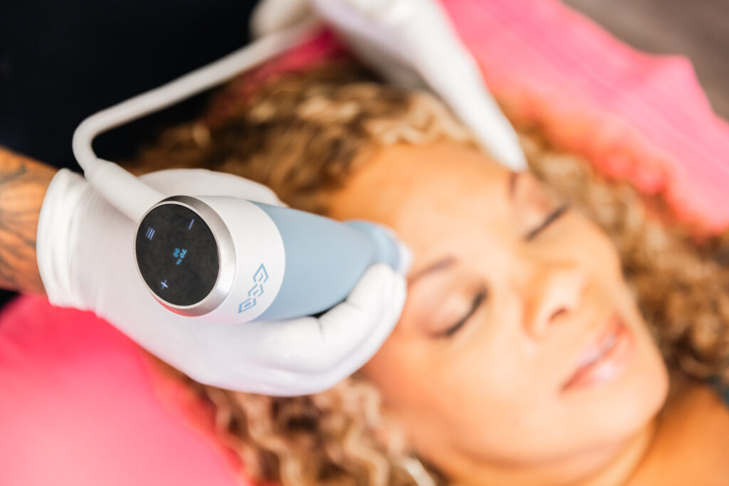 Close up of a person receiving RF microneedling near Plano at the Stoehr Center.